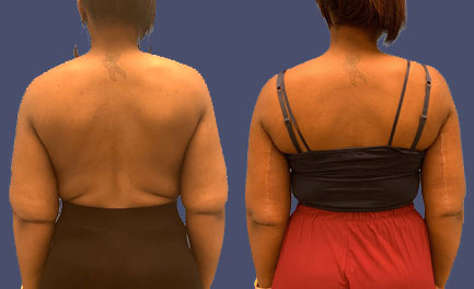 Before and After Results