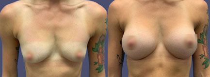 Before and After Results