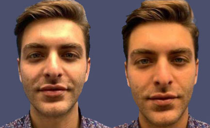Before and After Results