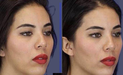 Before and After Results