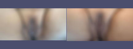 Before and After Results
