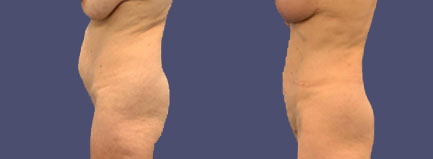 Before and After Results