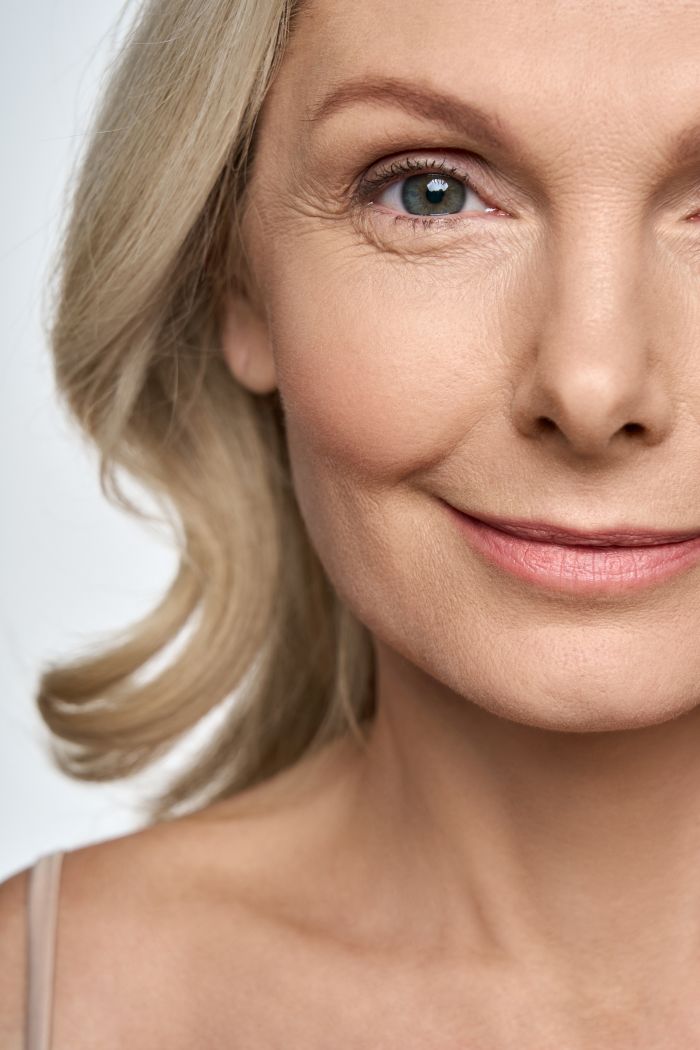 BOTOX® COSMETIC