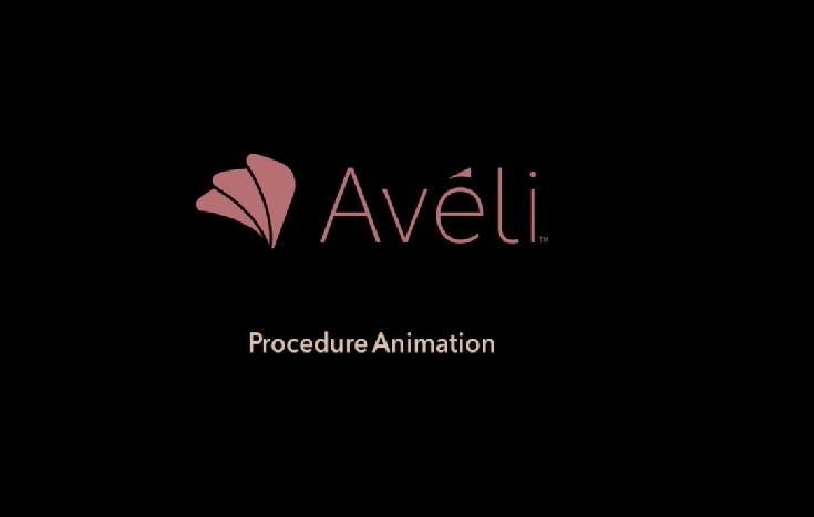 Aveli