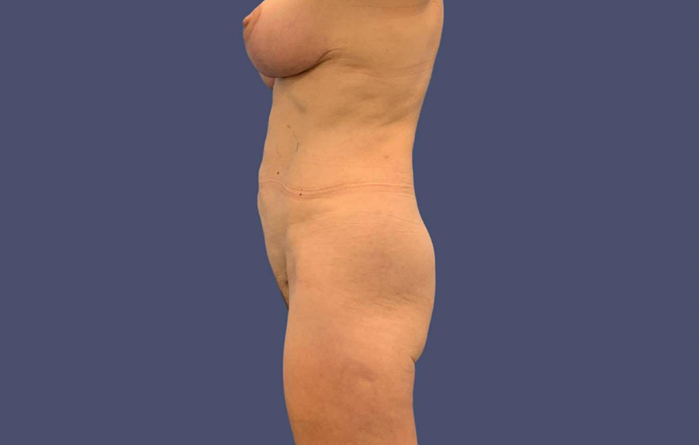 1519