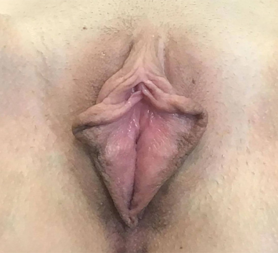 2396