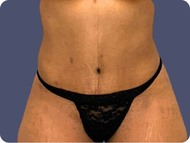 TT-3-2