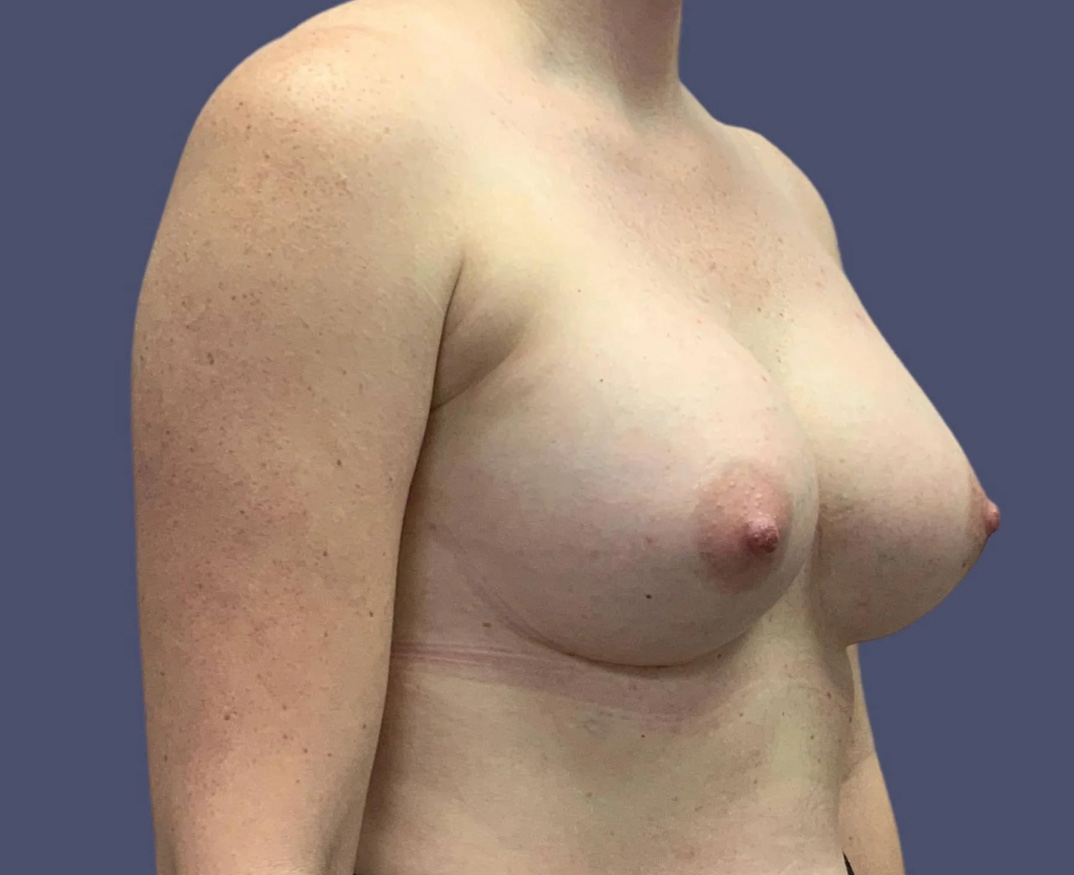 7020-p23-04-1