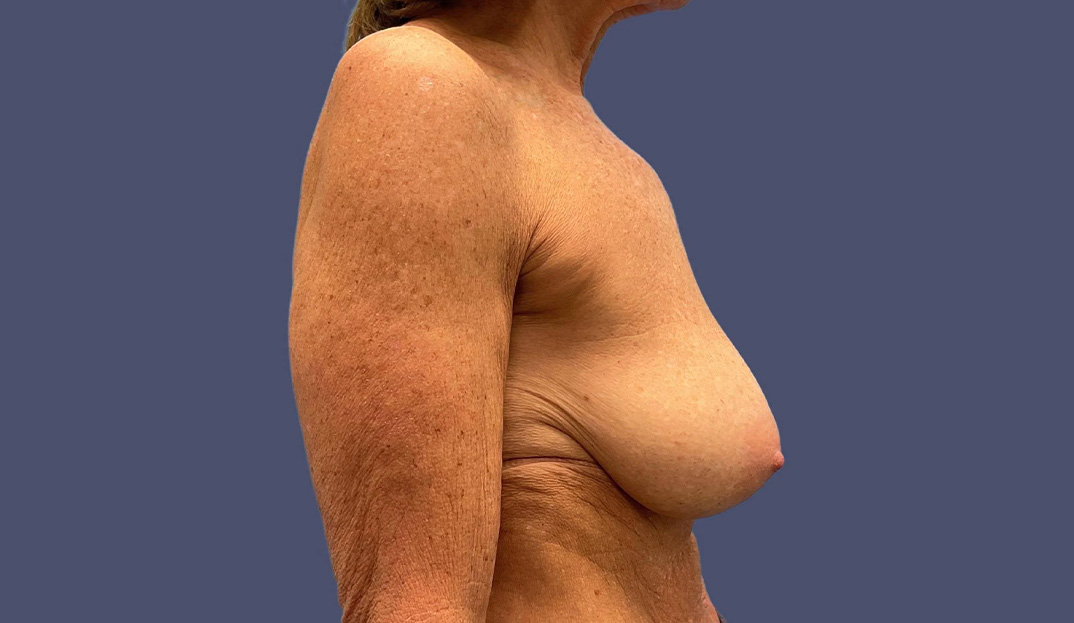 7298-p65-05-1