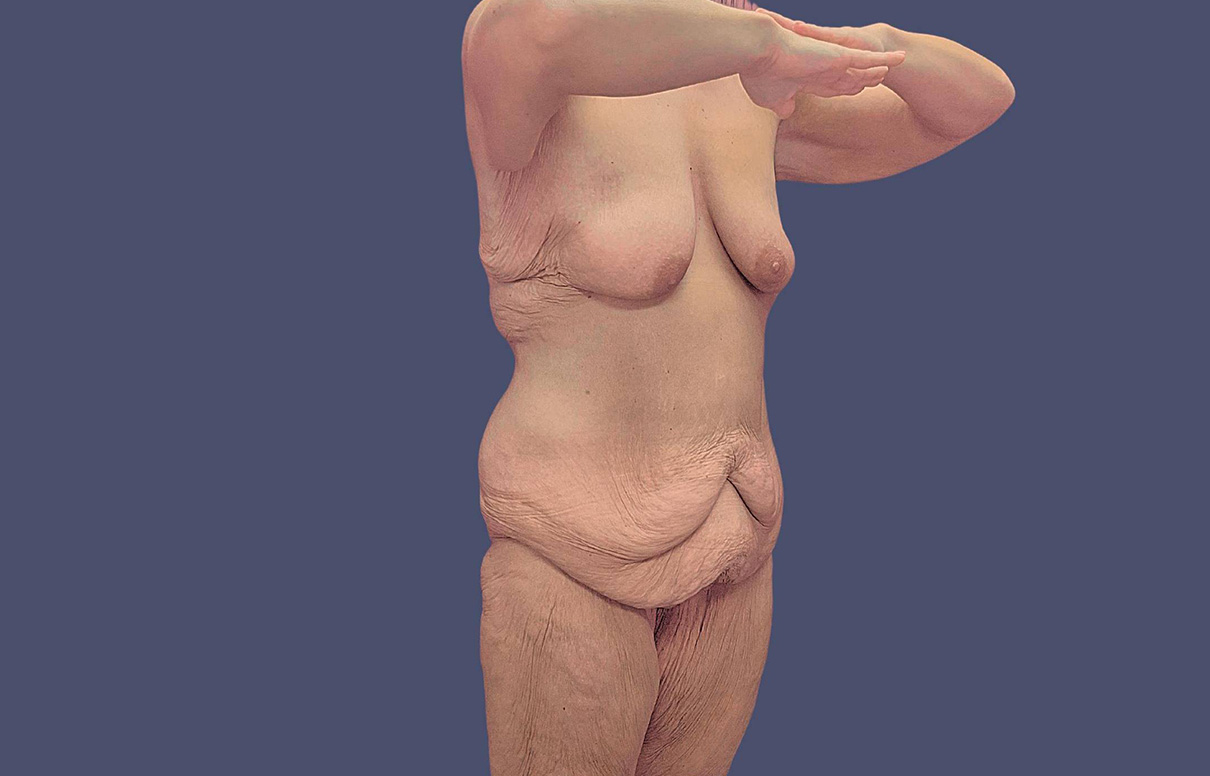 6758-p69-03