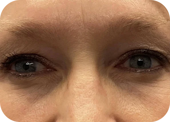 eye1