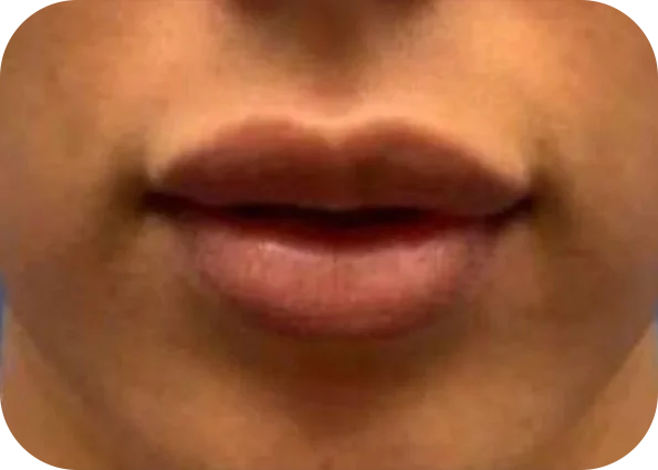 lip2