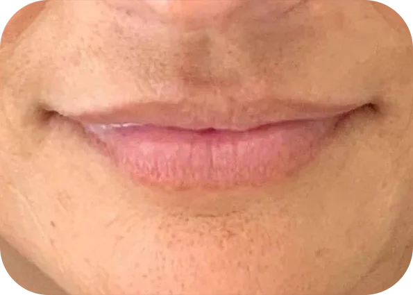 lip3