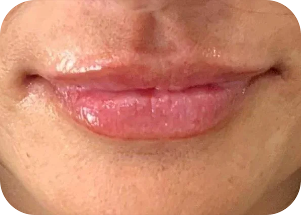 lip4