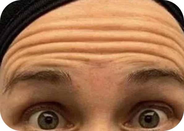 x1