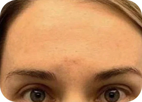 x2
