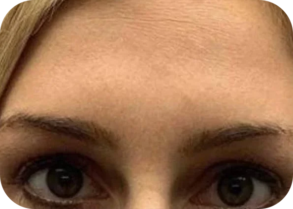 x4