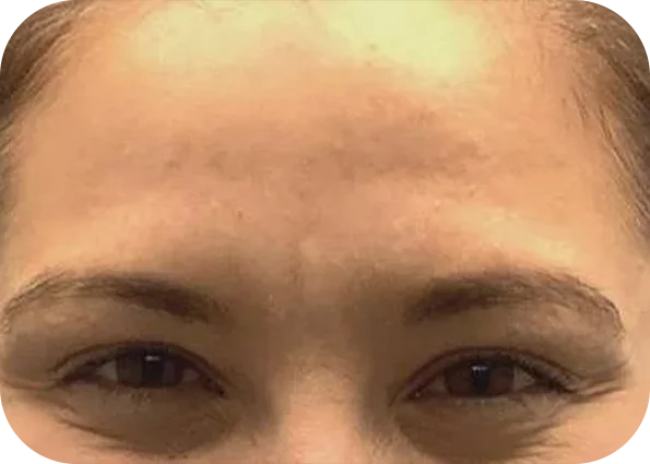 x6