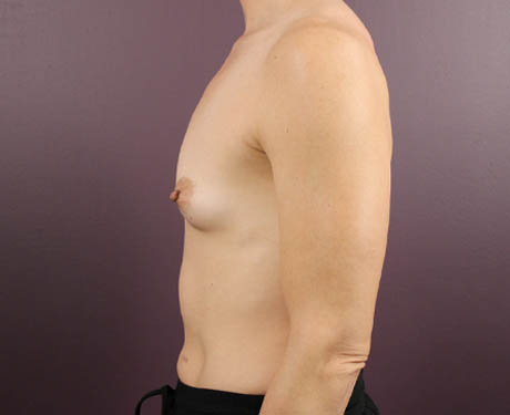 1_0006_baugAT (9).jpeg