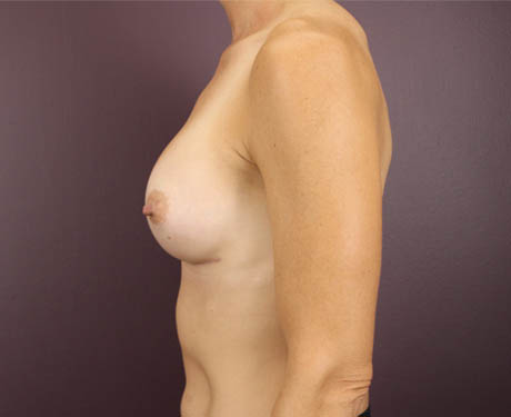 1_0007_baugAT (4).jpeg