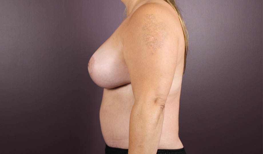 1_0017_BLBK (3).jpeg