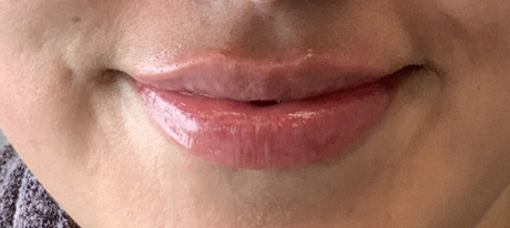 lip (2)