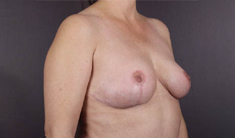 1_0007_imgi_15_Image-11-21-25-at-11.28-AM-1-e1763746515403.webp copy 3