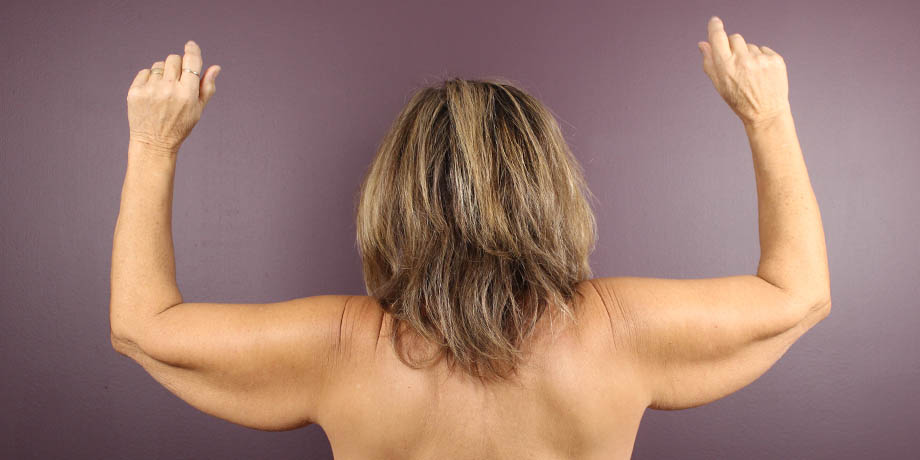 1_0000_barachmp (1).jpeg