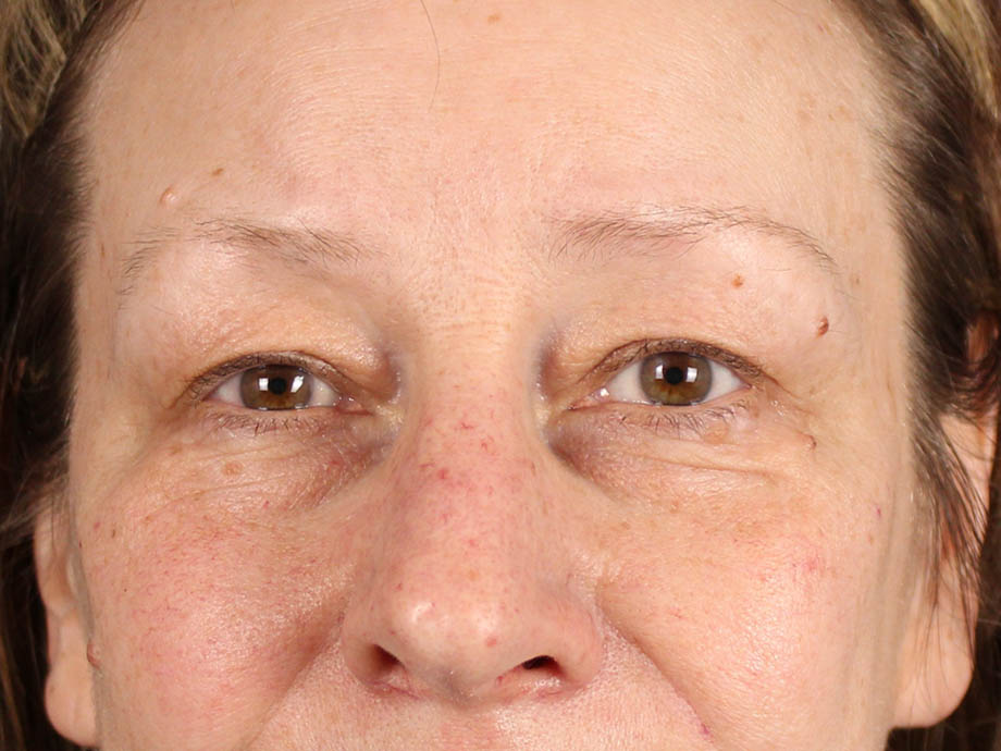 1_0000_kbblep (1).jpeg