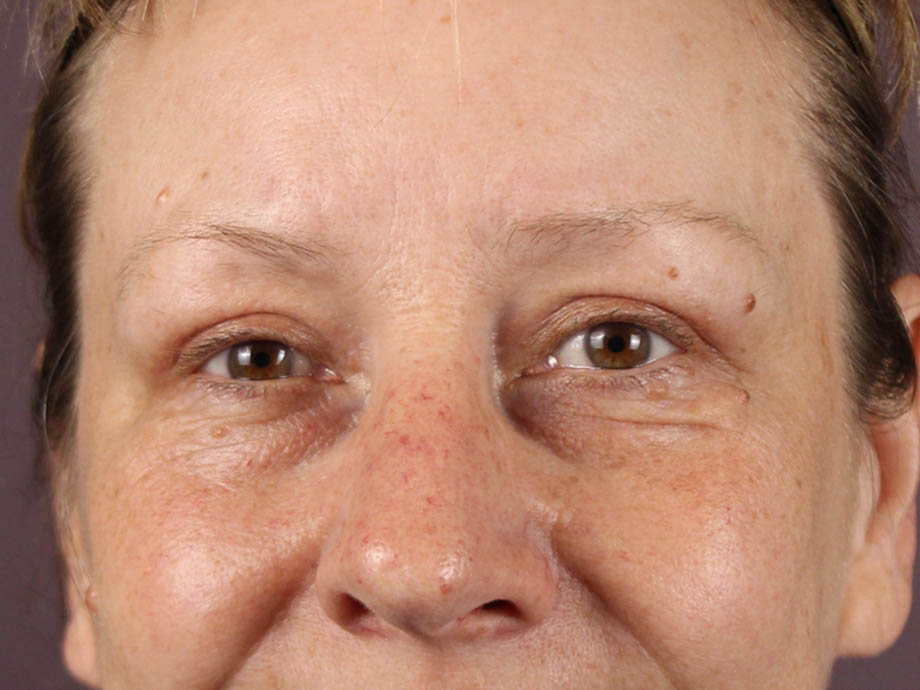 1_0001_kbblep (2).jpeg