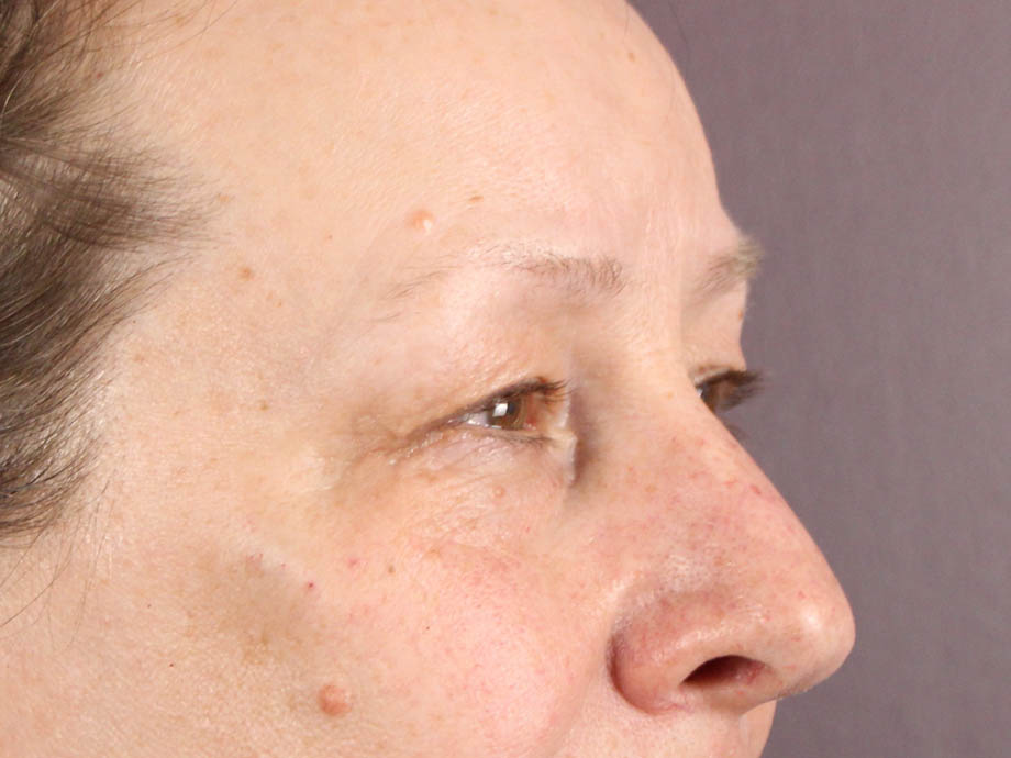 1_0002_kbblep (3).jpeg