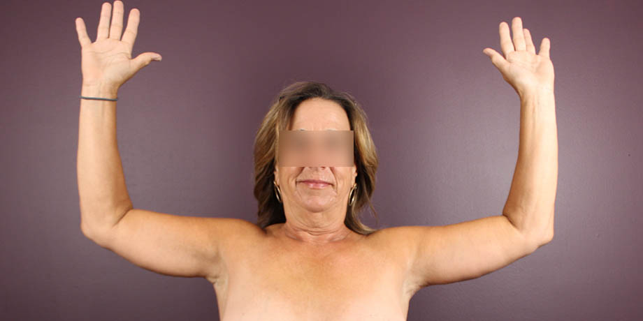 1_0003_barachmp (4).jpeg