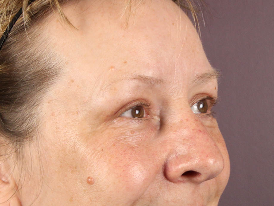 1_0003_kbblep (4).jpeg