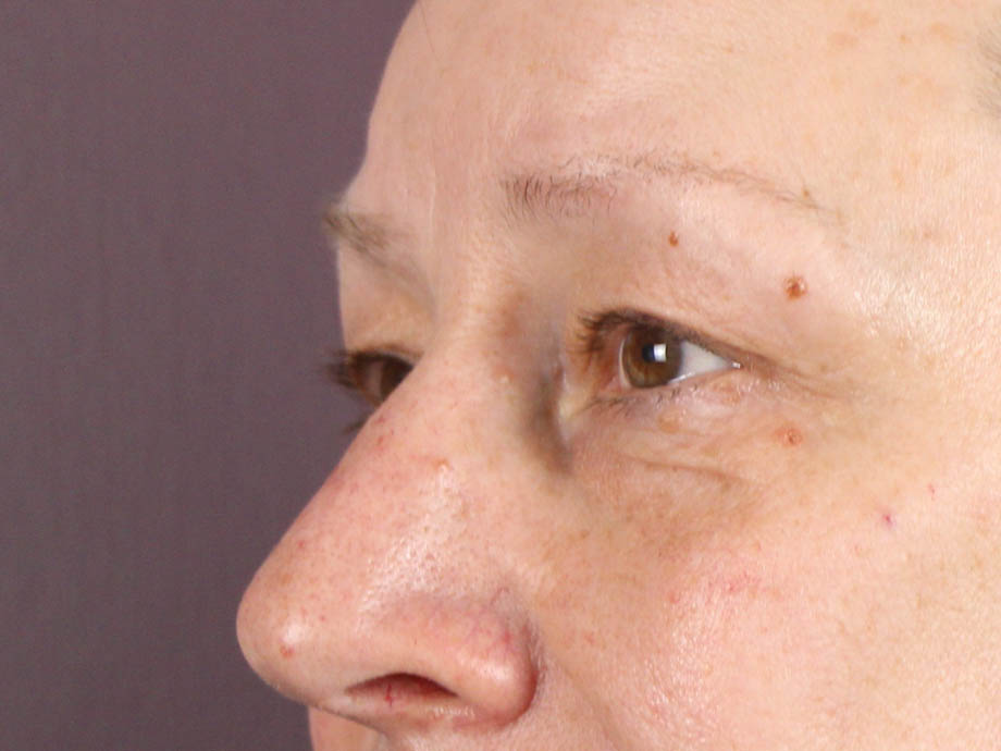 1_0004_kbblep (5).jpeg