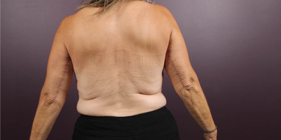 1_0005_barachmp (6).jpeg copy