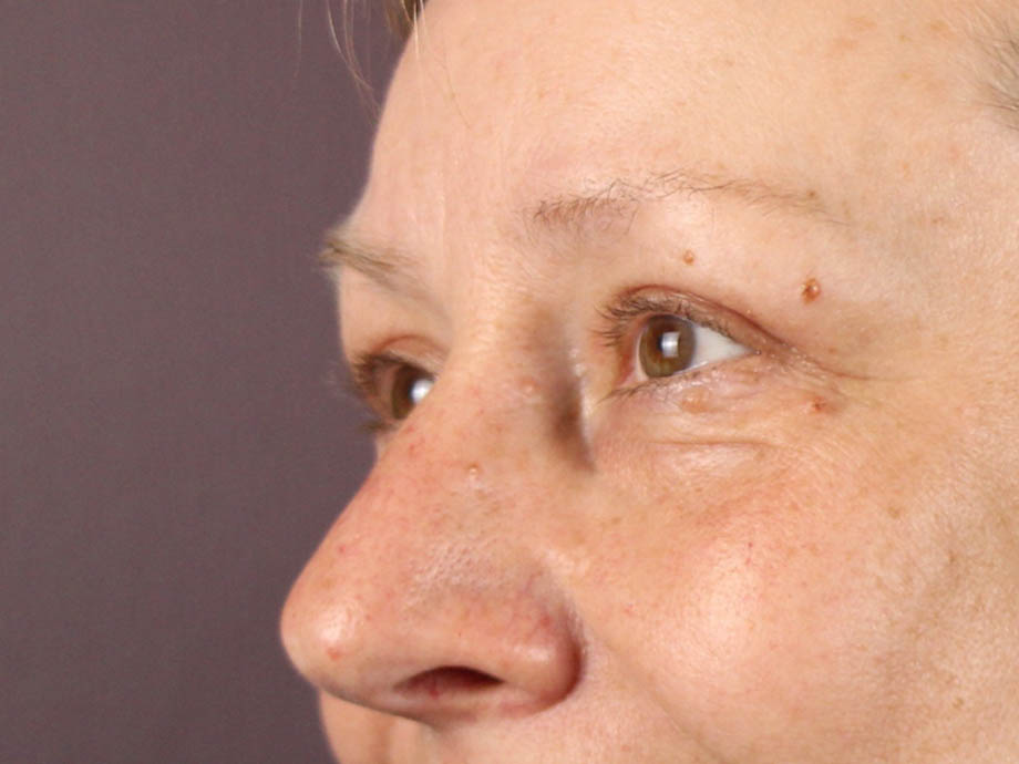 1_0005_kbblep (6).jpeg