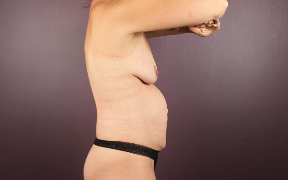 1_0018_Ttuck (9).JPG