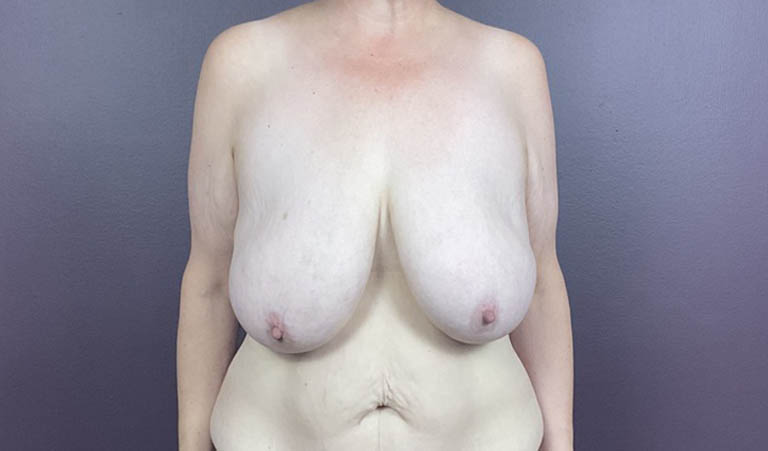 1_0020_MD-br (1).jpeg