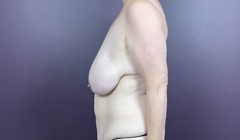 1_0024_MD-br (3).png