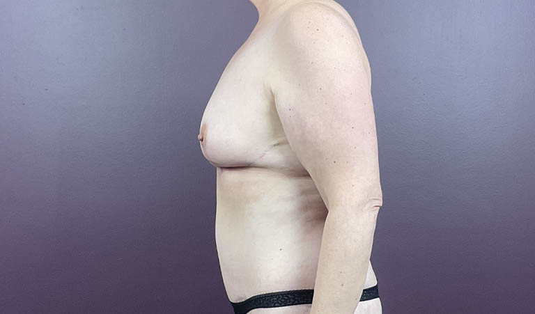 1_0025_MD-br (4).png