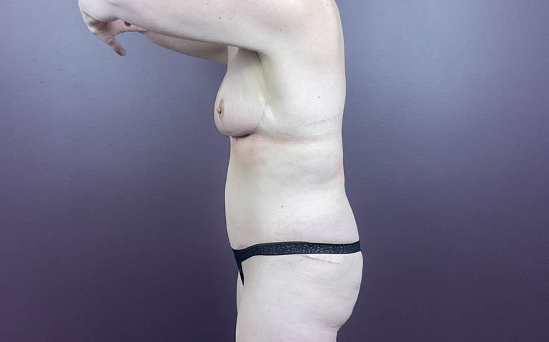 d_0025_md-tt (6).png