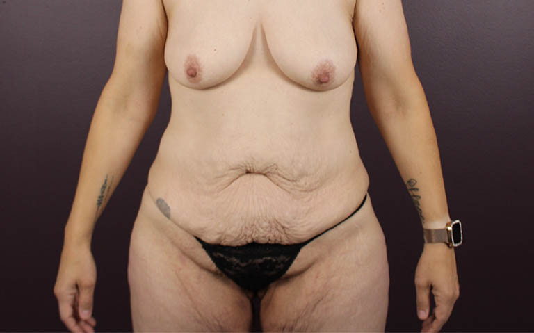 1_0012_matum (1).png