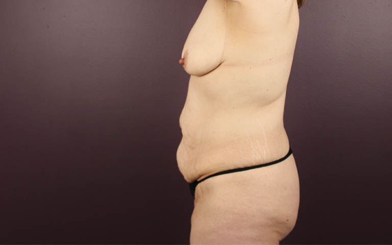 1_0016_matum (3).png