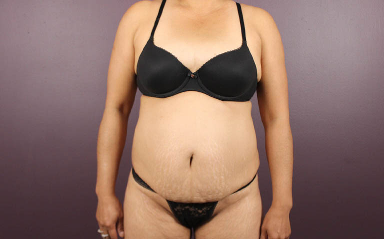 1_0022_RDtum (1).png