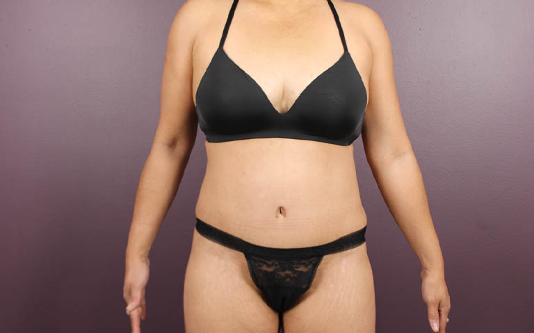 1_0023_RDtum (2).png