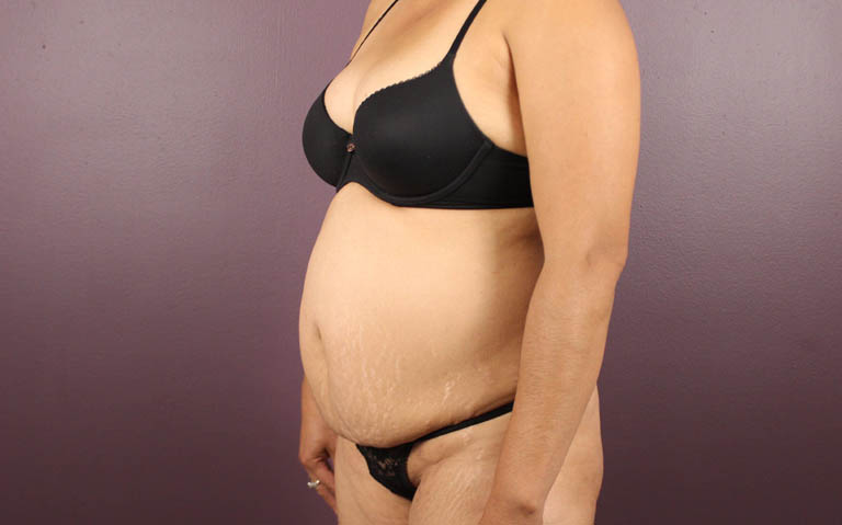 1_0024_RDtum (3).png