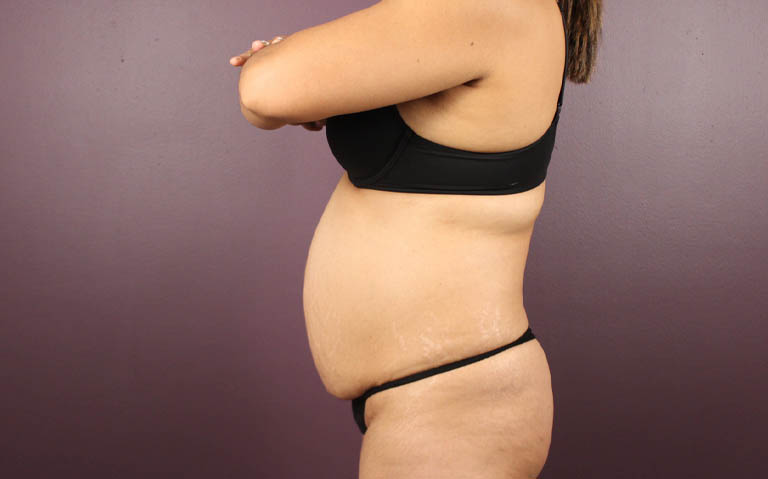 1_0026_RDtum (5).png