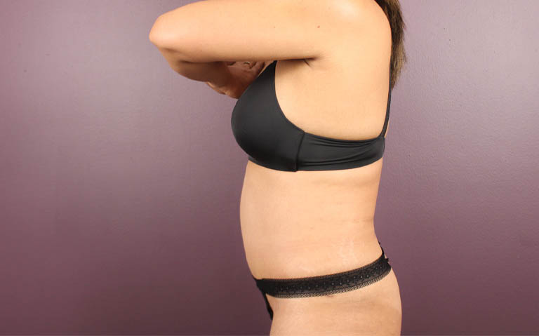 1_0027_RDtum (6).png