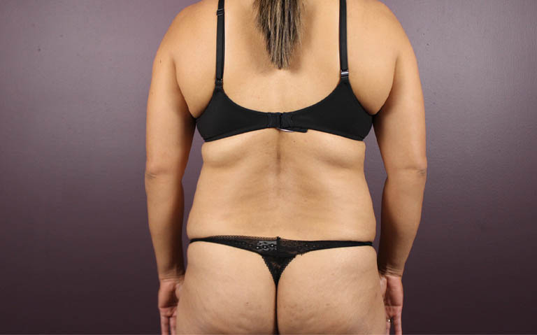 1_0028_RDtum (7).png