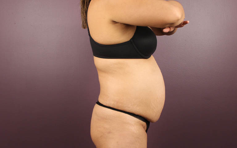 1_0030_RDtum (9).png